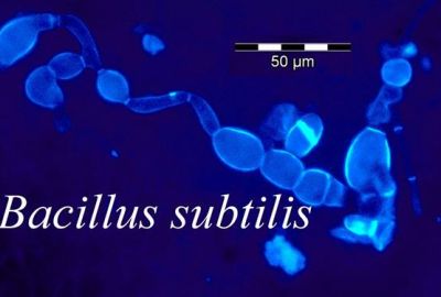 Bacillus Subtilis – Cân bằng hệ vi khuẩn đường ruột