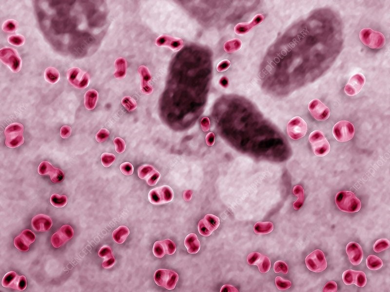 Vi khuẩn Pasteurella multocida gây bệnh tụ huyết trùng ở gà