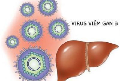 10 dấu hiệu nhận biết bệnh viêm gan siêu vi B