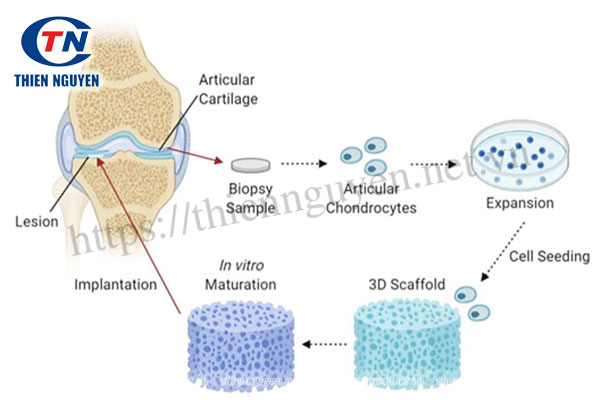 Sơ đồ minh họa quá trình thực hiện kỹ thuật mô sụn