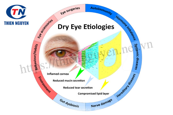 Nguyên nhân gây khô mắt và các bệnh có thể mắc phải khi bị khô mắt