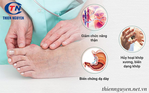 biến chứng của bệnh gout, cách điều trị bệnh gout