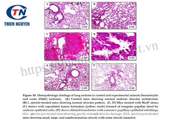 Lagerstroemia Speciosa extract làm suy yếu quá trình hình thành khối u phổi